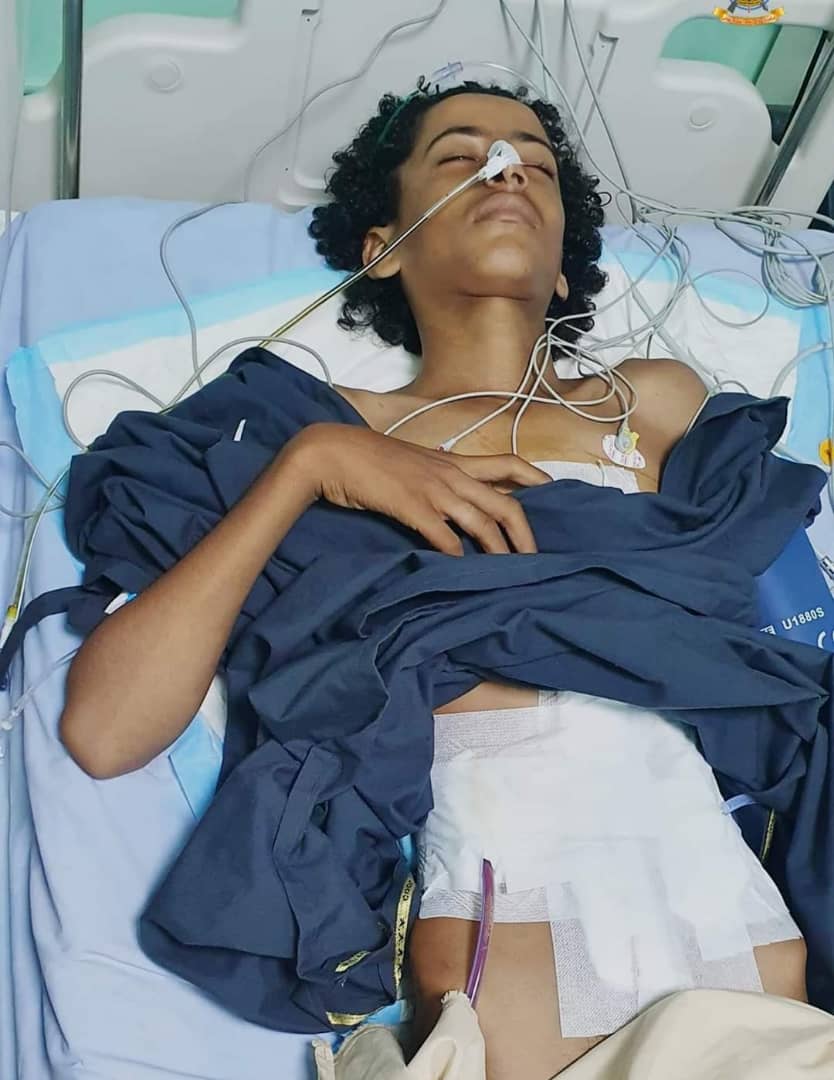 Child severely wounded in Houthi militia shelling in northwest Dhale, Yemen.