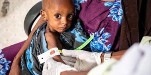 UNICEF: Al-Raimah leads Yemen in child stunting rates, with a staggering 69% affected.