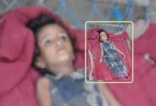 Humanitarian tragedy in Hajjah: A child and an elderly woman die of starvation amid Houthi restrictions on aid.